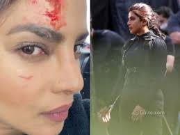 2 days ago · priyanka chopra recently shared a picture of the injury that she suffered on her eyebrows while shooting for her upcoming web series citadel. Nzxwmhon1xflem
