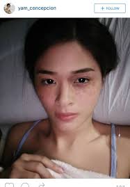 This page is updated often with latest details about yam concepcion. Pictures Of Yam Concepcion