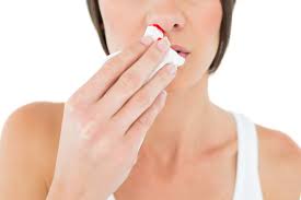Get advice from 111 now if you think you have a blood clot. How To Stop A Bloody Nose