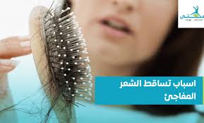 اسباب تساقط الشعر المفاجئ وطرق علاجه Sudden Hair Loss Hair Care Hair Loss