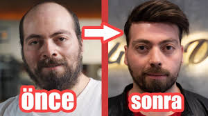30 Gunde 10 Yas Genclestim Inanilmaz Degisim Youtube