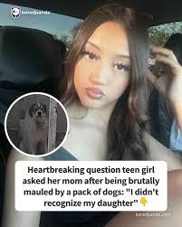 Heartbreaking question teen girl asked her mom after being brutally mauled  by a pack of dogs: "I didn't recognize my daughter" (link in the comments)