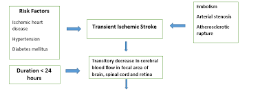 Image result for Stroke Pathophysiology