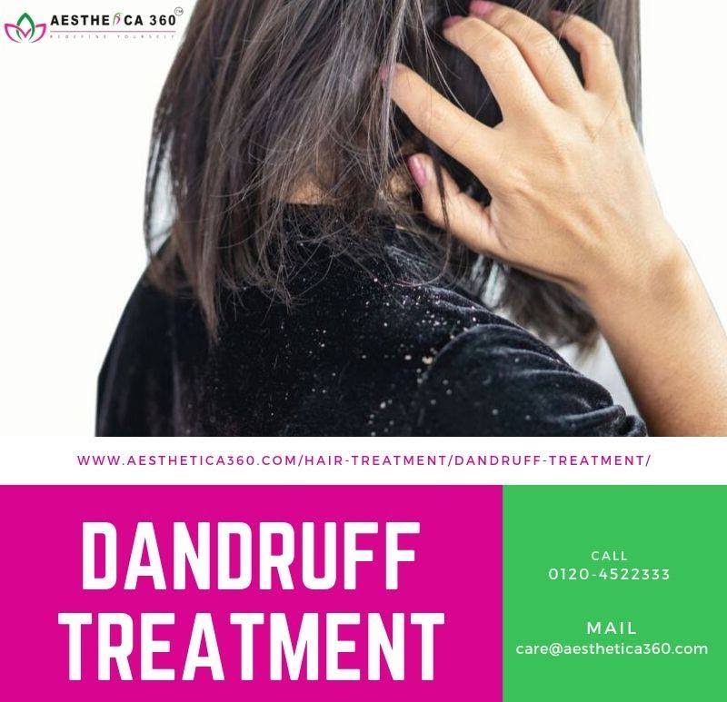 Dandruff Treatment product image