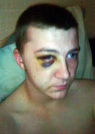 South Shields victim hits out as attacker walks free