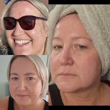 Nutrition's role in healthy skin