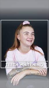 Millie Bracewell chose Erdem Dental Clinic for teeth whitening. She was  very pleased with the results. She had a pleasant experience. #erdemdental  #dentalclinic #DentalAssistant #dentalcare #dentalimplant #dentalveneers  #dentaltreatment #dentaltourism ...