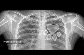 Xray Of My Heart Dog Love Dog Lovers Dog Quotes