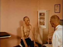 Indonesian old man emaciated thin stock photos. Emaciated Stock Footage Royalty Free Stock Videos Pond5