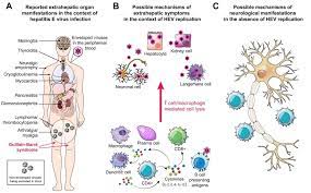 Hepatitis E Virus Infection Beyond The Liver Journal Of Hepatology