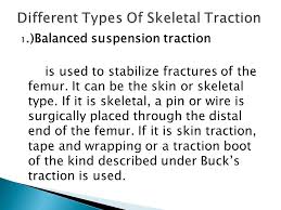 Is The Use Of A Pulling Force To Treat Muscle And Skeleton Disorders Ppt Video Online Download