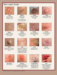 skin lesion guide faculty of medicine