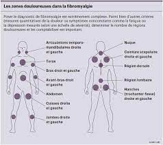 La fibromyalgie est un syndrome caractérisé par des douleurs diffuses dans tout le corps, douleurs associées à une grande fatigue et à des troubles du sommeil. La Fibromyalgie Est Un Mal Qui N A Rien D Imaginaire Planete Sante