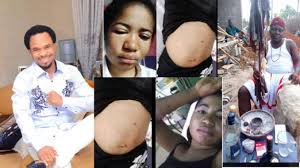 Comedienne mercy cynthia ginikanwa aka ada jesus, 23, has been reported died.she died on wednesday before her demise, ada jesus publicly sought forgiveness from those she offended. Popular Native Doctor Chi Marine Forgives Seriously Sick Ada Jesus At His Shrine Performs Rituals To Reverse Curses Laid On Her While Prophet Odumeje Refuses To Forgive Sick Comedian Ada Jesus Says