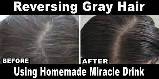 Reverse Your Gray Hair Using This Miracle Drink Family Health Freedom Network Reverse Gray Hair Grey Hair Remedies Hair Help