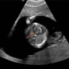 E. Cazorla's research works