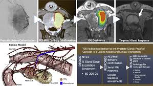 Very often surgery can cause numerous complications (one of which is urinary incontinence). Yttrium 90 Radioembolization To The Prostate Gland Proof Of Concept In A Canine Model And Clinical Translation Journal Of Vascular And Interventional Radiology