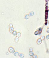 Diagnose Der Candida Endomykose Ubersicht