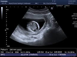 Du bist neugierig was in deinem körper und bei deinem baby in der 10. Praxis Veltmann Heinig Schwangerschaft