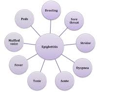 Image result for Epiglottitis