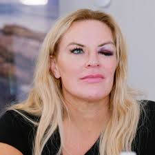 RHOSLC' Finale: Heather Gay Finally Reveals Who Gave Her That Infamous  Black Eye