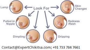 Of course, your specialist is the main person whose advice you should follow but it doesn't do anyone harm. Breast Cancer Treatment In India Find Best Breast Cancer Specialists Cost Estimate Success Rate Contact Us Now