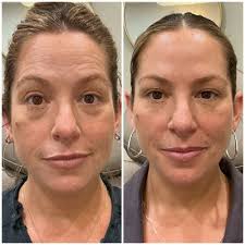 TOP 10 BEST Ear Candling in Sacramento, CA