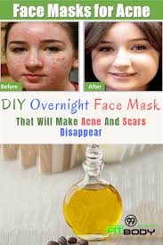 Pin On How To Make Peel Mask