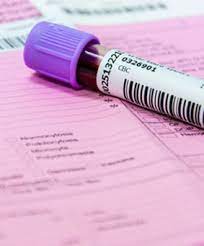 Non Hodgkin Lymphom Lebenserwartung Lymphozyten