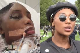 First picture of shot BLM activist Sasha Johnson in hospital