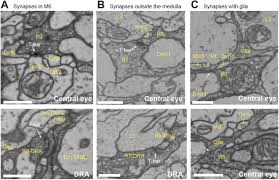 5 downloads 75 views 266kb central venous pressure (cvp) adalah suatu hasil dari pengukuran tekanan vena sentral. Synaptic Targets Of Photoreceptors Specialized To Detect Color And Skylight Polarization In Drosophila Biorxiv