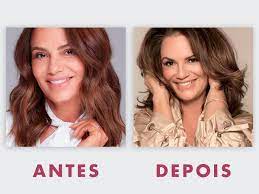 Blefaroplastia Antes E Depois Fotos E Dicas Dream Plastic