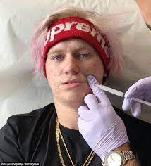 Supreme has collaborated with several. Instagram Star Supreme Patty Smokes Hot Sauce For Likes Daily Mail Online