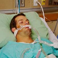When is a ventilator used? When Is Mechanical Ventilation Harmful To The Lung Healthmanagement Org