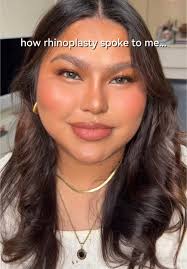 Understanding Rhinoplasty: How It Speaks to My Experience