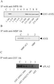 Palo alto waterfront homes for sale. Inhibition Of Cytosolic Phospholipase A2 By Annexin I Specific Interaction Model And Mapping Of The Interaction Site Sciencedirect