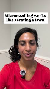 Microneedling is similar to aerating a lawn: we are creating channels to  allow “good fertilizer” to go in and generate new collagen. #esthetician  #roswellga #medspa #microneedling