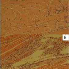 Image result for Fadogia tetraquetra