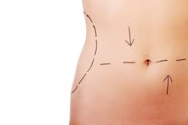 Kalo gemar nonton film korea jepang atau hollywood yang aktor dan aktrisnya punya badan bagus dan pipi. Hilangkan Lemak Di Perut Buncit Dengan Body Contouring Pure Laser Clinic Indonesia