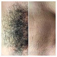 Sign up for free to find a farmer, rancher, cowboy, cowgirl or animal lover here at farmersonly. Twitter à®‡à®² Monique Minor Before And After Brazilian Wax What A Difference Moniqueminor Legwax Legwaxing Brazilianwax Summerready Smoothskin Smoothlegs Underarmwax Pleasantonca Downtownpleasanton Downtownpleasantonsalon