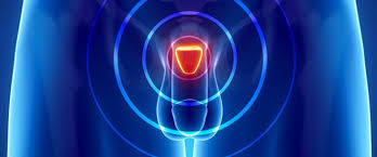 The pancreas is a bodily organ that few people think about. Prostatitis Treatment In Germany Switzerland