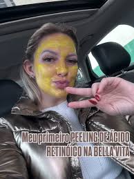 Vem ver um resuminho de como foi o meu primeiro peeling de ácido retinóico  na @bellavita.esteticaavancada Já agenda o seuuuu! Vale super a pena! A  pele fica com um glow lindo! 🤩