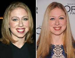 Hillary clinton plastic surgery facelift. Pin On Star Celeb Surgery