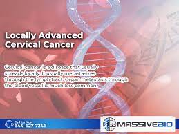 Maybe you would like to learn more about one of these? Locally Advanced Cervical Cancer Stage 1b2 To 4a Massive Bio