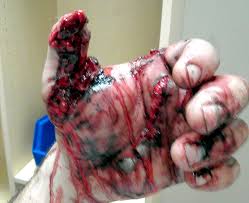 50 Cal Wound Pics How Damaging Are 50 Caliber Bullet Wounds Quora 50 Bmg Tr Ammunition Box Lucilan Robot