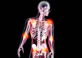 Le Mystere De La Fibromyalgie