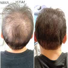 Ankara Sac Simulasyonu Ve Microblading Kil Teknigi Kas Merkezi