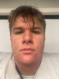 District 10 football: 30 NW PA offensive linemen to watch in 2022