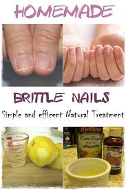 My Little Beauty Corner Be Your Own Kind Of Beautiful Brittle Nails Brittle Nails Treatment Argan Oil For Hair Loss