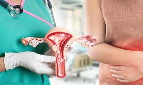 In later stages, symptoms could include: Cervical Cancer Symptoms Unusual Bleeding A Sign You Should See A Doctor Now Express Co Uk